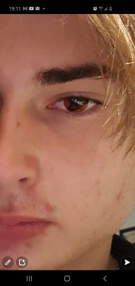 Reseña fotográfica de los contactos Uchiha Sharingan totalmente activados